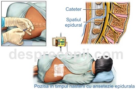 Anestezia dentară - tipuri, complicații - Clinică Accesibilă Bucuresti - Blog IVORY Dentfix