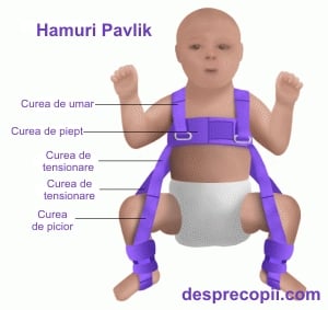 Displazia de șold la bebeluși - cauze și tratament - csdownload.ro