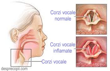 Laringita La Copil Desprecopii Com