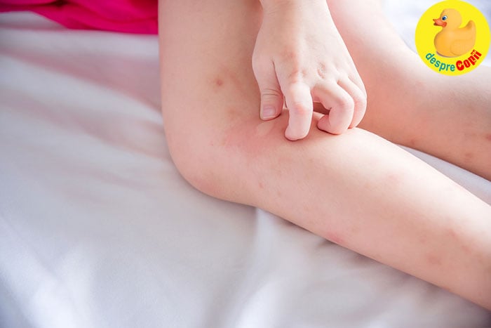 Cauze și tratamentul picioarelor mâncărime sub genunchi - Medici