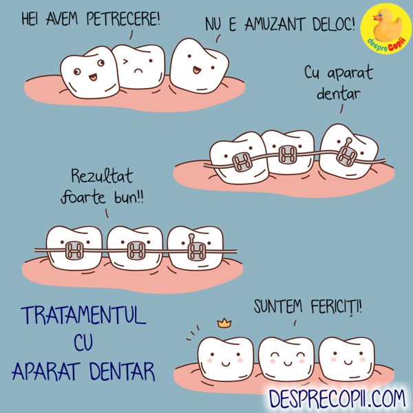 aparat dentar copil