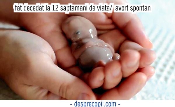 Cele Mai Frecvente 5 Cauze Ale Avortului Spontan Desprecopii Com