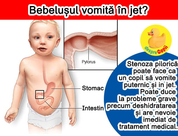 bebelusul voma in jet