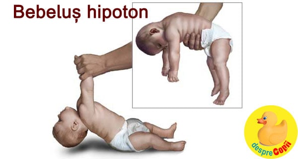 bebelus hipoton