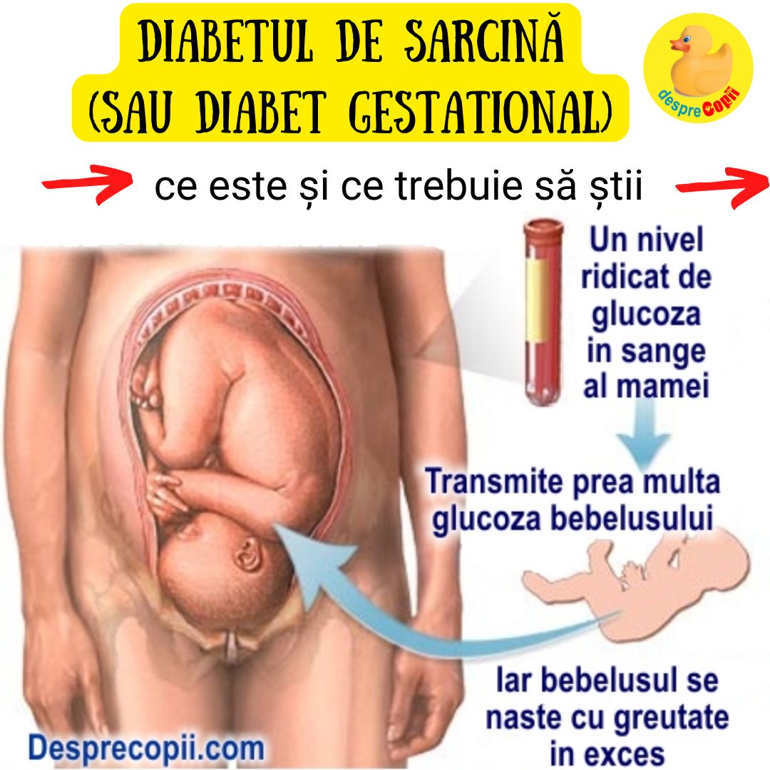 diabet de sarcina