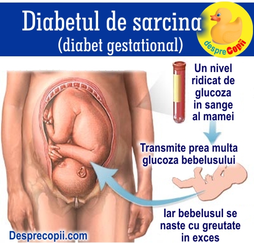 diabet de sarcina