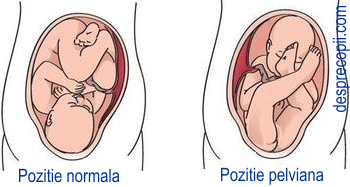 Displazia de sold: necesitatea operatiei in cazul adultilor