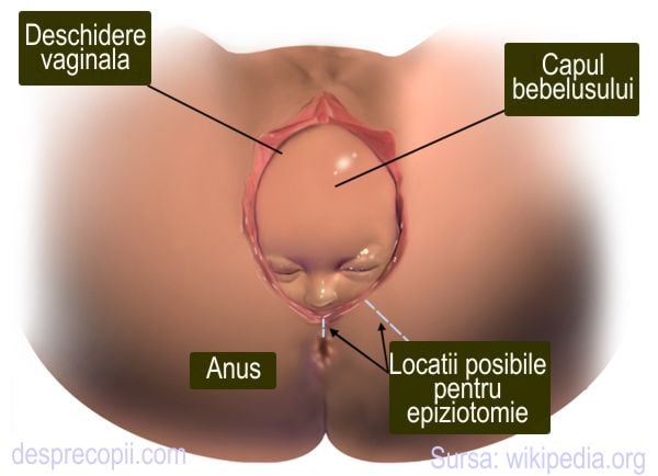 Epiziotomia la nastere