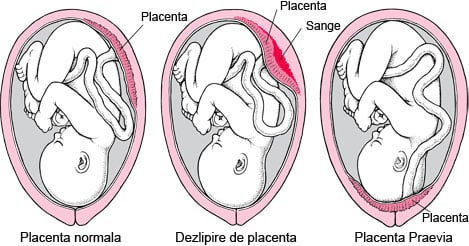 /Images/foto placenta dezlipita.jpg