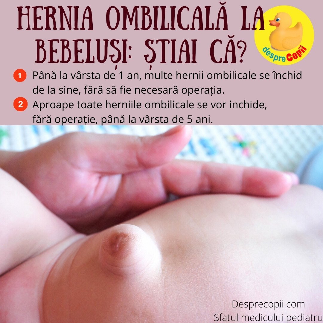 hernie ombilcala bebelusi