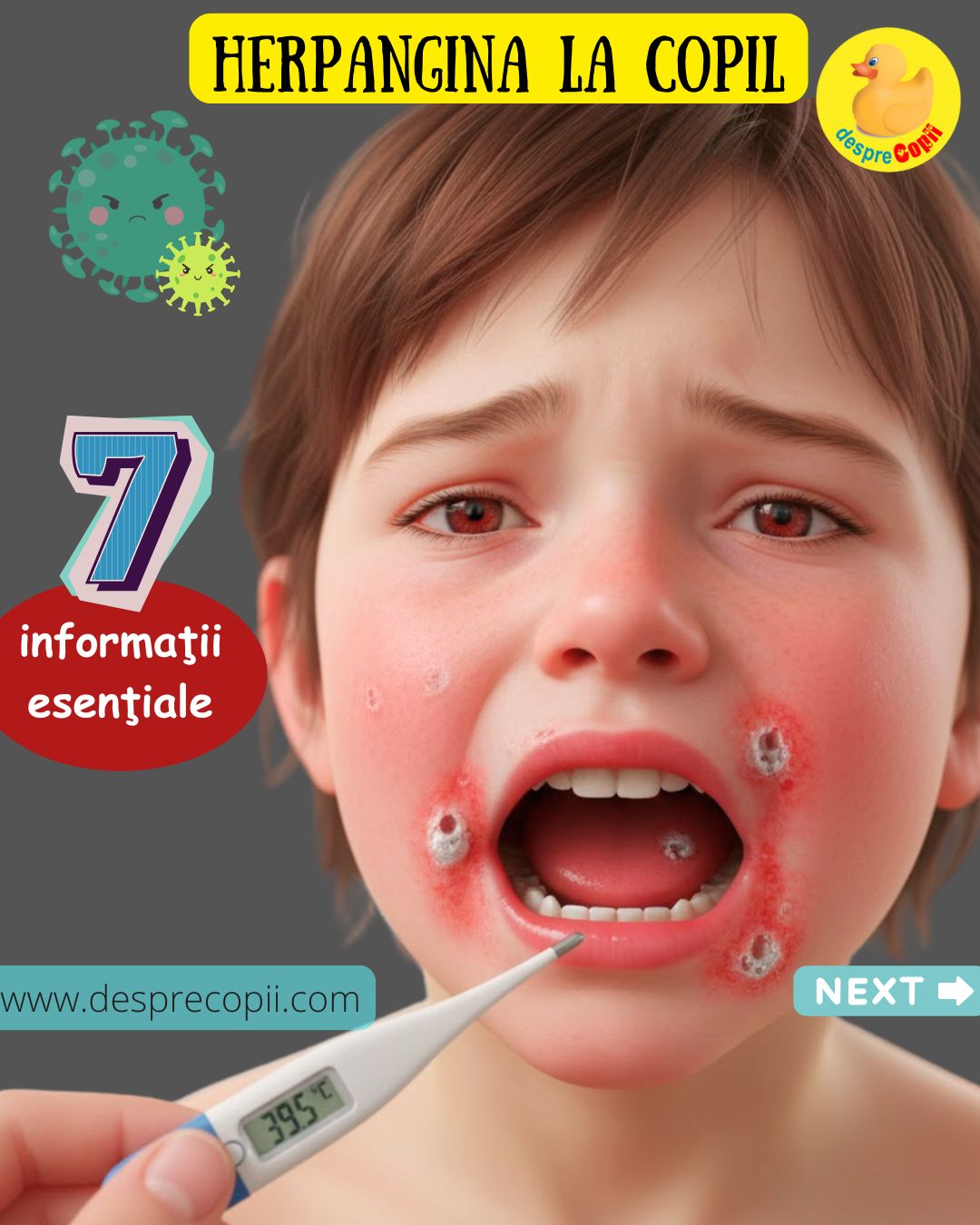herpangina copil 1