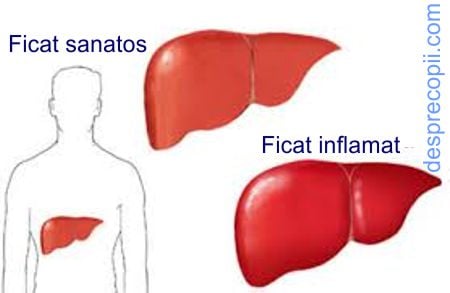 hepatita copil