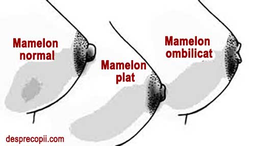 Mameloanele ombilicate