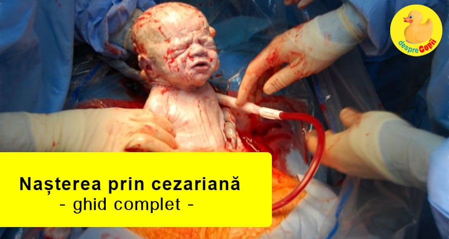 nasterea prin cezariana