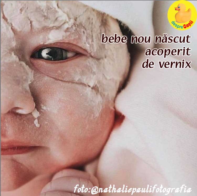 vernix bebelus nou nascut