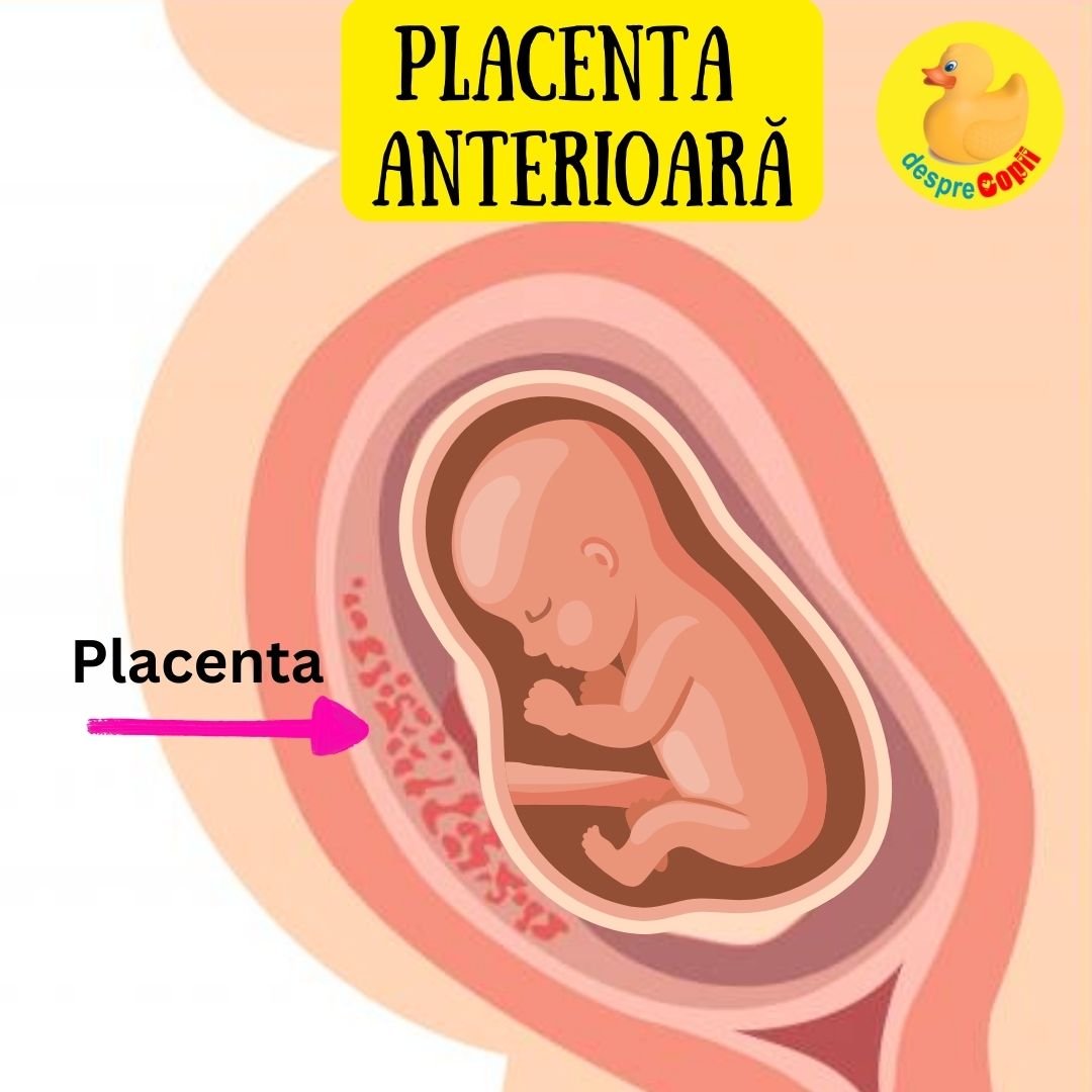 placenta anterioara