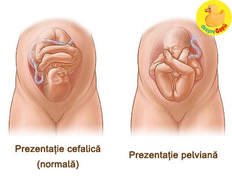 pozitia bebelusulu sarcina