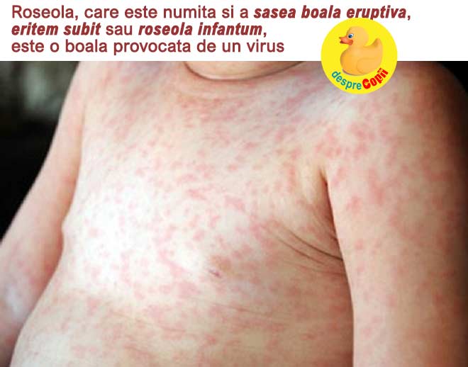 roseola copil