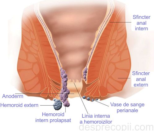 Hemoroizii Si Sarcina Desprecopii Com