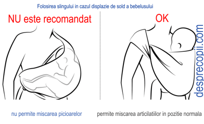 Tratament bilateral de displazie de șold la adulți