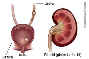 Infectiile Urinare La Femei I Cauze Tratament Si Prevenire