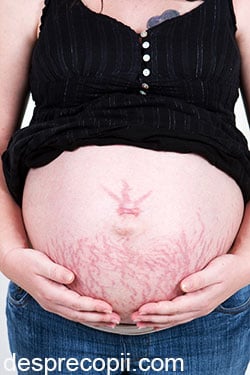 Uleiuri pentru vergeturi in timpul sarcinii
