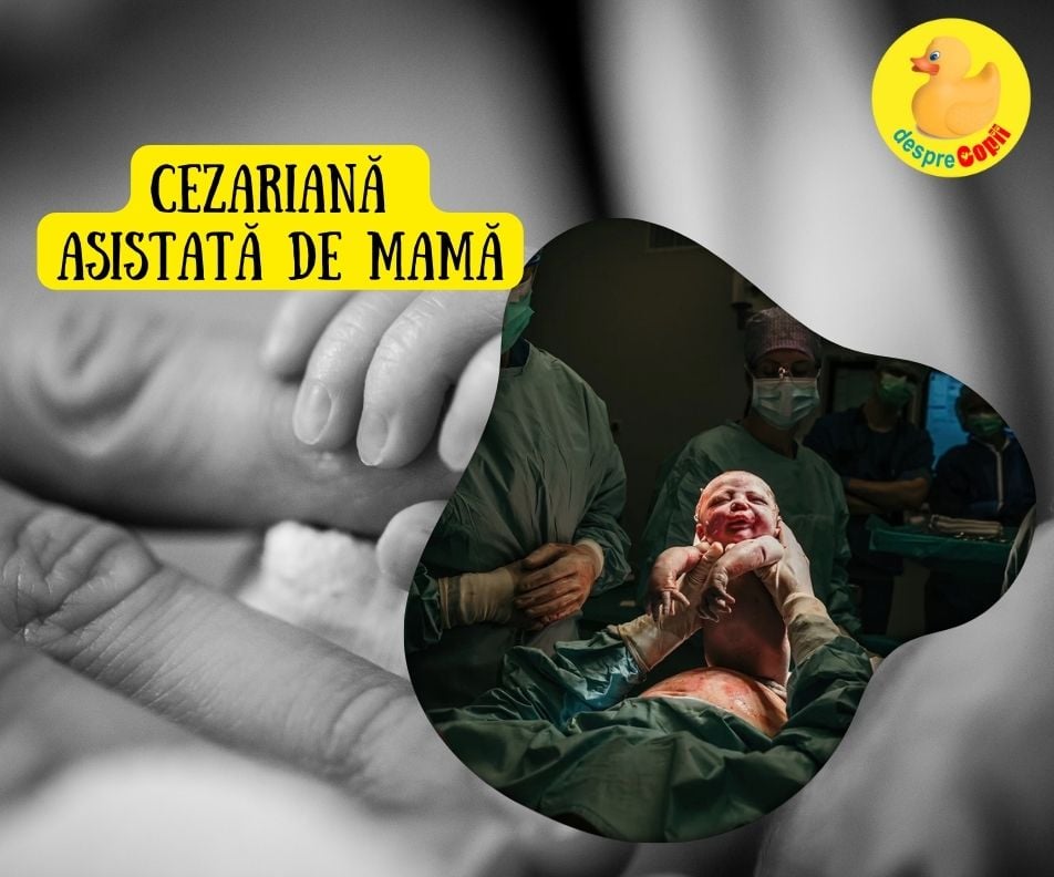 Nasterea cezariana asistata de mama sau Cezariana ca o experienta speciala prin implicarea mamei