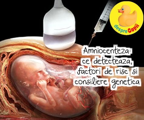 Amniocenteza in sarcină: ce detectează, factori de risc și consiliere genetică - sfatul medicului