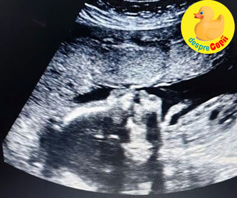 La a cincea sarcina -  ecografia de la 30 saptamani si riscul unei nasteri premature - jurnal de sarcina