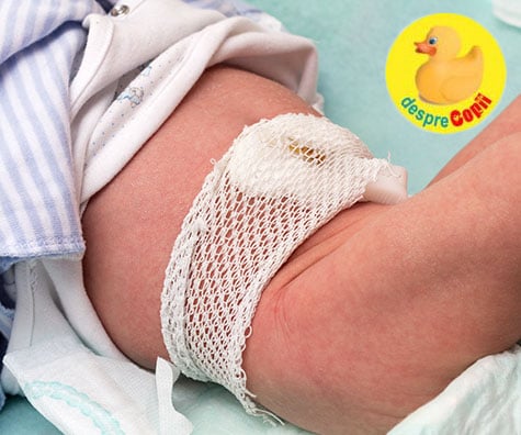 Igiena corectă a buricului nou-născutului - 10 sfaturi pentru părinți de la medicul pediatru