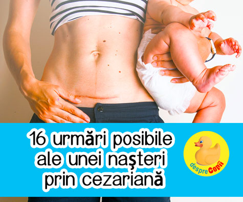 16 urmări posibile ale unei nașteri prin CEZARIANĂ