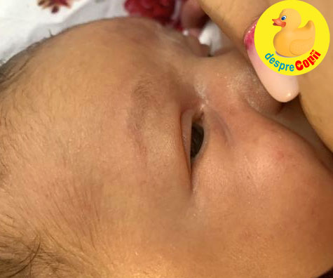 Prima vizita la medic cu bebe la varsta de 10 zile - jurnal de mami