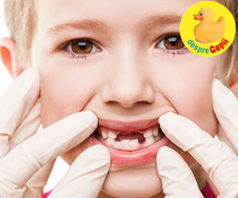Ce se intampla cand copiii isi pierd prea devreme dintii de lapte? - sfatul medicului stomatolog pediatru