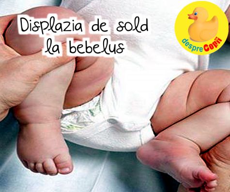 Displazia de sold. Cauze si simptome