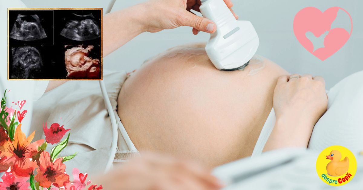 Saptamana 37 si bucuria risipita a ultimei ecografii cu bebe - jurnal de sarcina width=