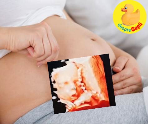 Morfologia de trimestrul 2 si miscarile lui bebe - jurnal de sarcina