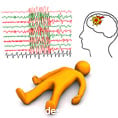 Epilepsia la copil