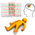 Epilepsia la copil