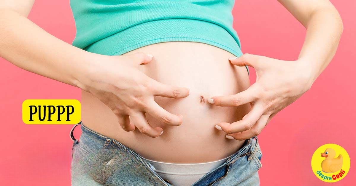Eruptia cutanata PUPPP in timpul sarcinii - ce o cauzeaza si cum trebuie tratata width=