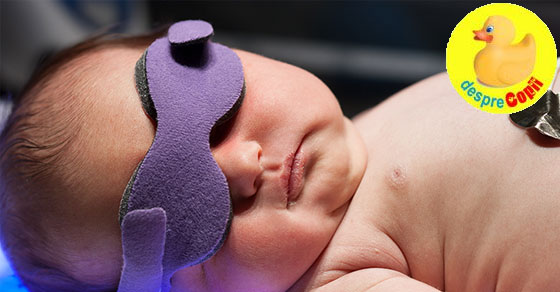 Icterul la nou nascuti: forme si tratament - sfatul medicului