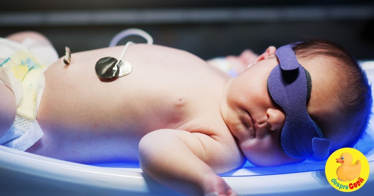 Icterul la nou născuți: forme și tratament - sfatul medicului