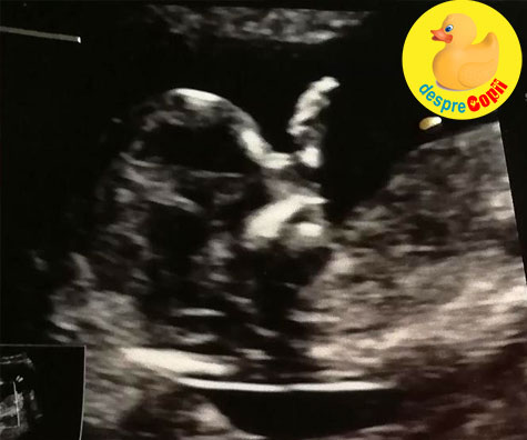 Morfologia trimestrului unu in saptamana 13 -  bebe nu dorea sa coopereze - jurnal de sarcina