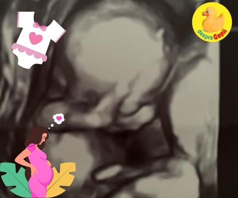 Saptamana 20: la morfologia de trimestru II am aflat sexul bebelusului - jurnal de sarcina