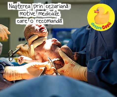 Nașterea prin cezariană: motive medicale care o recomandă și sfatul medicului