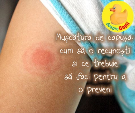 Muscatura de capusa - cum sa o recunosti si ce e de facut