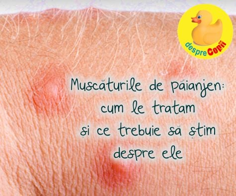 Mușcăturile de păianjen - cum le recunoaștem și ce facem