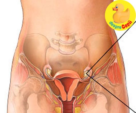 Sindromul ovarului polichistic: simptome și tratament