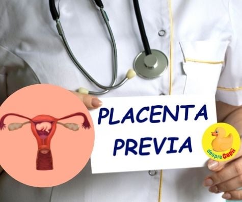 Placenta previa -  in cele mai multe cazuri se rezolva de la sine. Simptome si factori de risc - sfatul medicilor