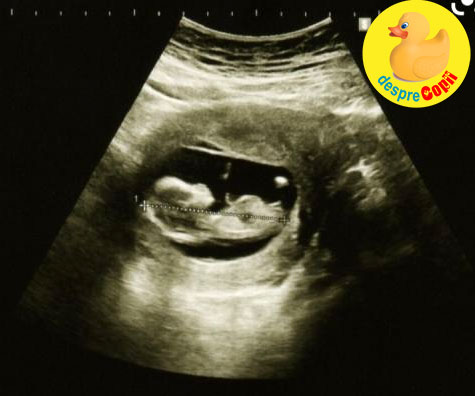 Prima ecografie la 5 luni: bebe dormea cu degetul in gurita - jurnal de sarcina