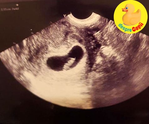 A treia sarcina -  prima ecografie in saptamana 7 - jurnal de sarcina